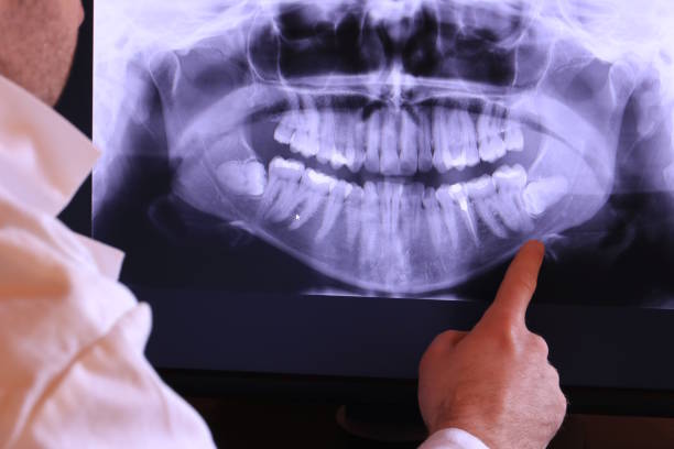 Best Chipped Tooth Repair Near Me  in Nevada, TX